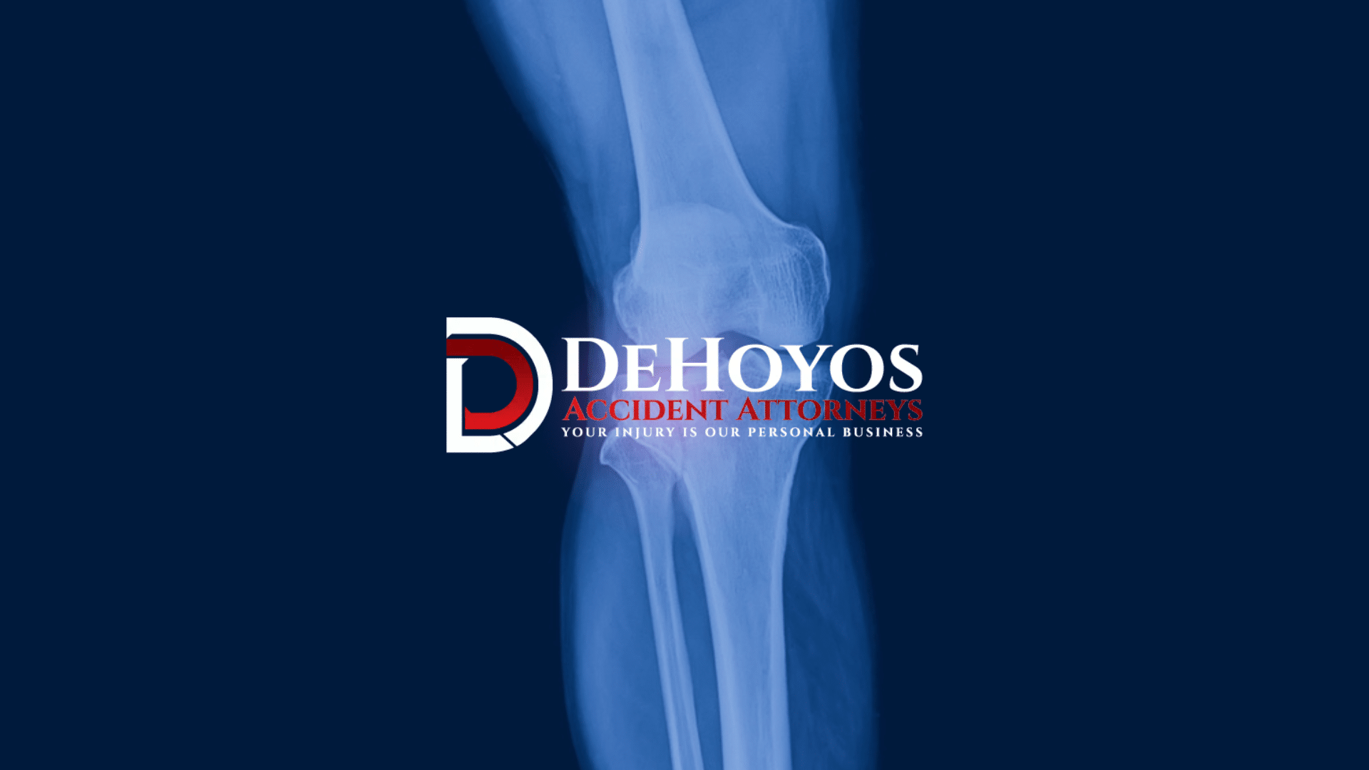 Pearland Knee Injury Lawyer Attorney